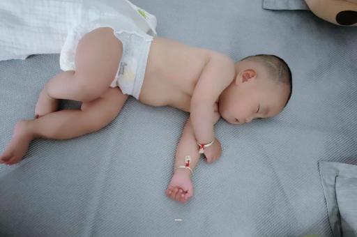 府谷宝宝脸上有白色斑块